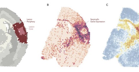 Groundbreaking study maps brain’s recovery process after stroke using ...