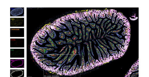 New opportunities for studying spatial proteomics